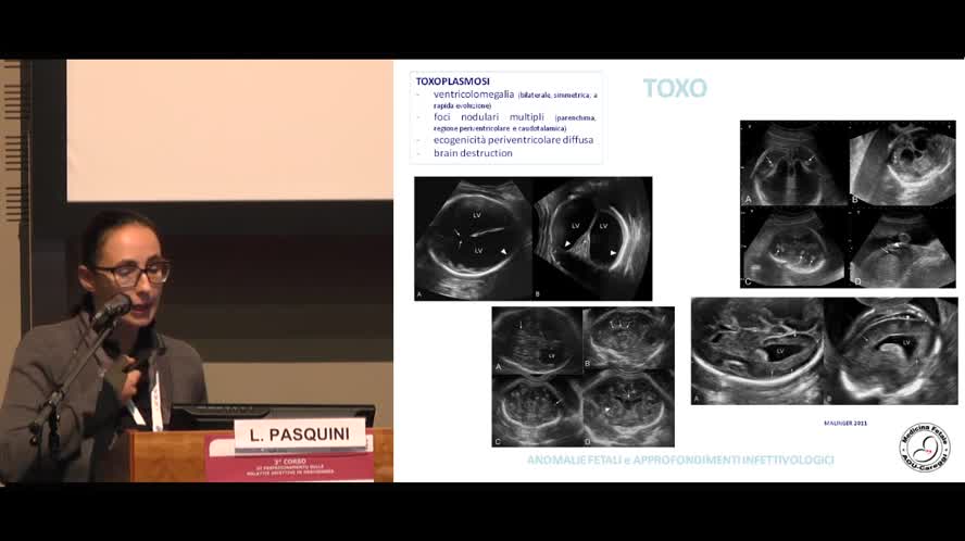 Diagnosi ecografica di anomalie fetali e approfondimenti diagnostici infettivologici