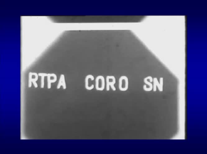 Fisiopatologia e terapia IMA