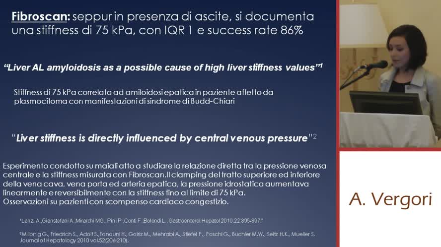 Sindrome di Budd Chiari in malattia mieloproliferativa