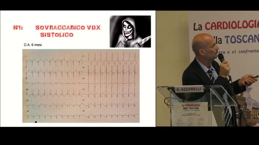 L'ECG neonatale e pediatrico: L'ABC per il cardiologo dell'adulto, quadri normali e patologici, quando stare tranquilli, quando preoccuparsi