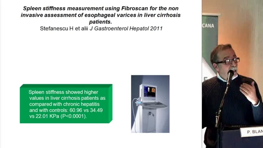 Il Fibroscan