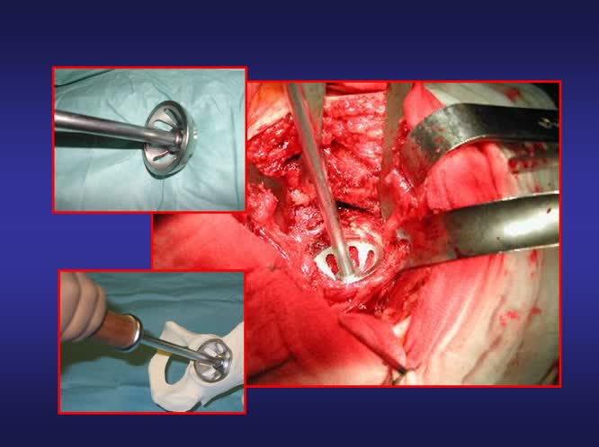 Teste di grande diametro