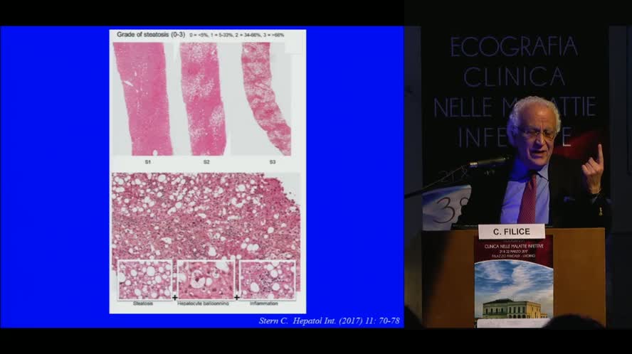 Il ruolo delle metodiche elastosonografice nella valutazione della fibrosi epatica