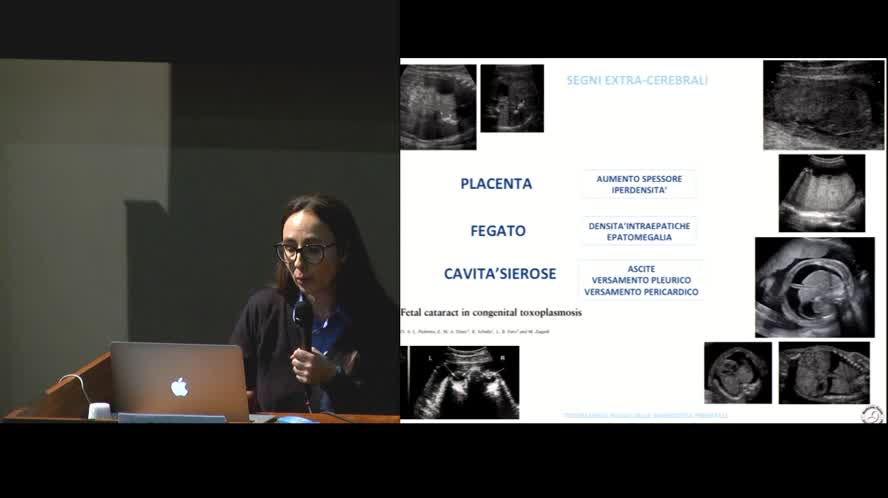 Toxoplasmosi in gravidanza