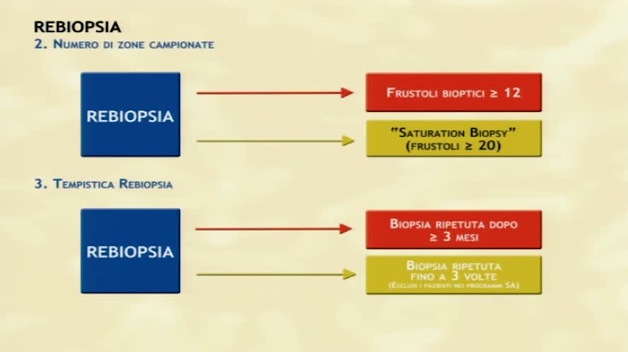 La biopsia prostatica: quando e come