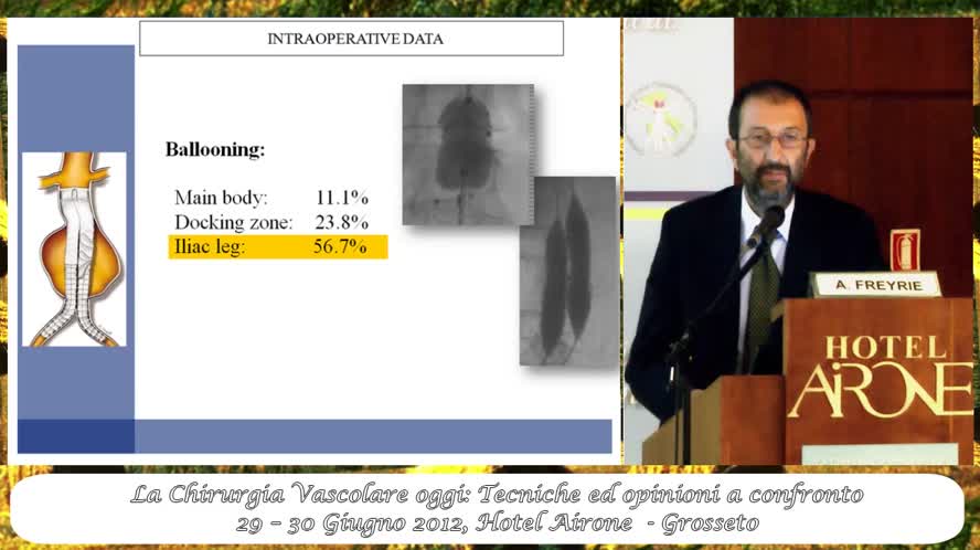 Risultati del registro italiano Anaconda nel trattamento endovascolare degli AAA