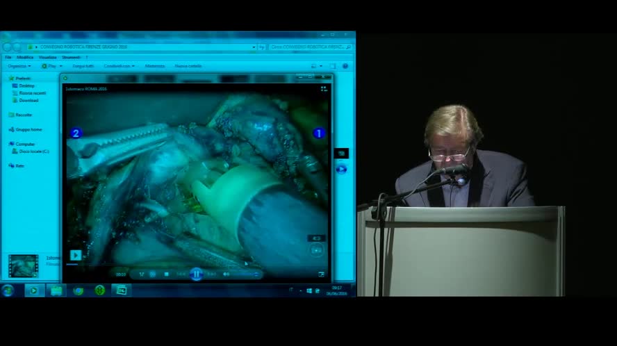 Historical memory of laparoscopic and robotic surgery