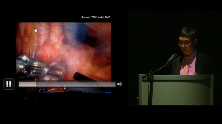 Minimally invasive TME: robotic vs laparoscopic approach