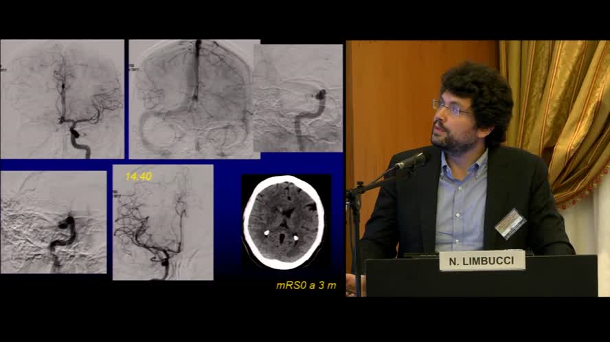 Neuroradiologia interventistica: ictus ischemico ed emorragico
