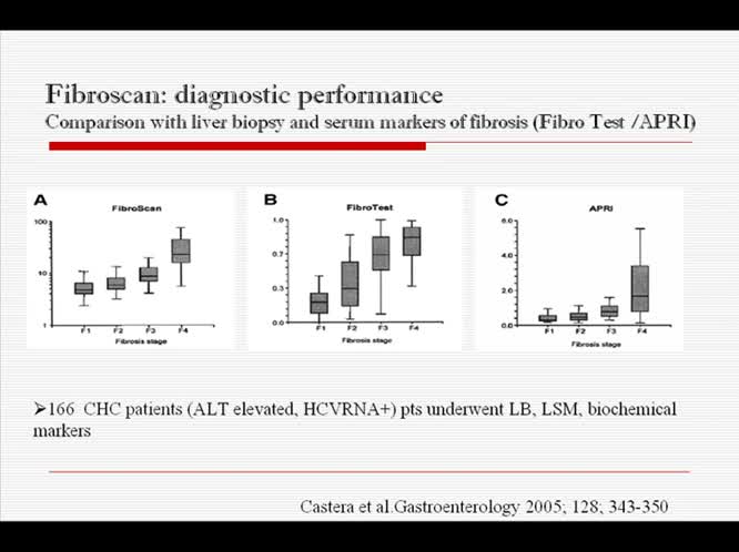 Il fibroscan una nuova risorsa nel controllo dell'epatopatia