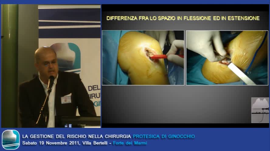 Protesi mono: Indicazione e tecnica