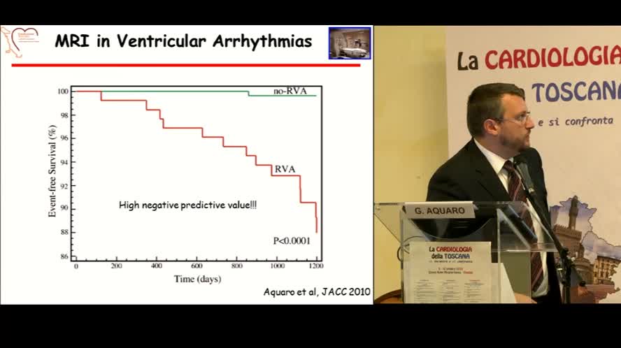 Quando e perché la RMN cardiaca