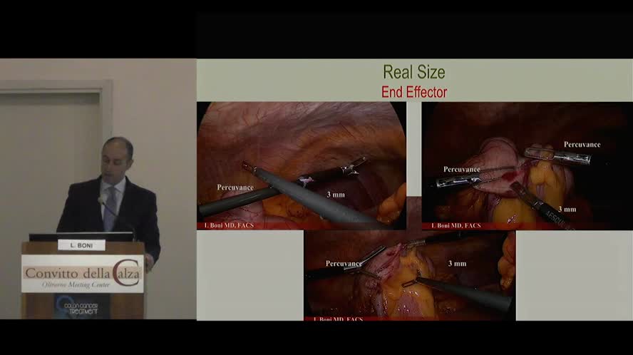 Reducing the trauma in Laparoscopic surgery