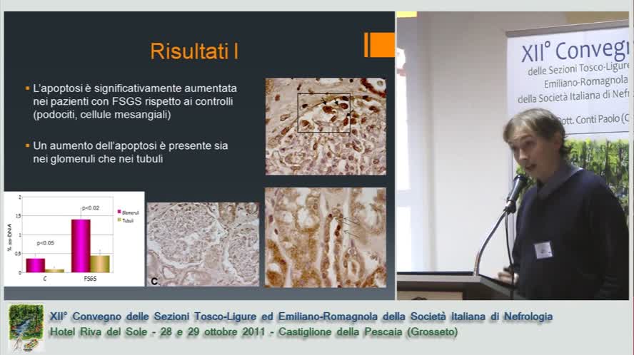 Ruolo di apoptosi e senescenza delle cellule glomerulari nella GSFS idiopatica