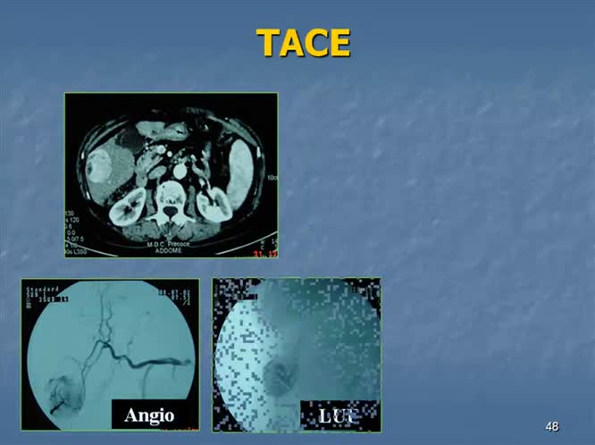 Trattamento loco-regionale