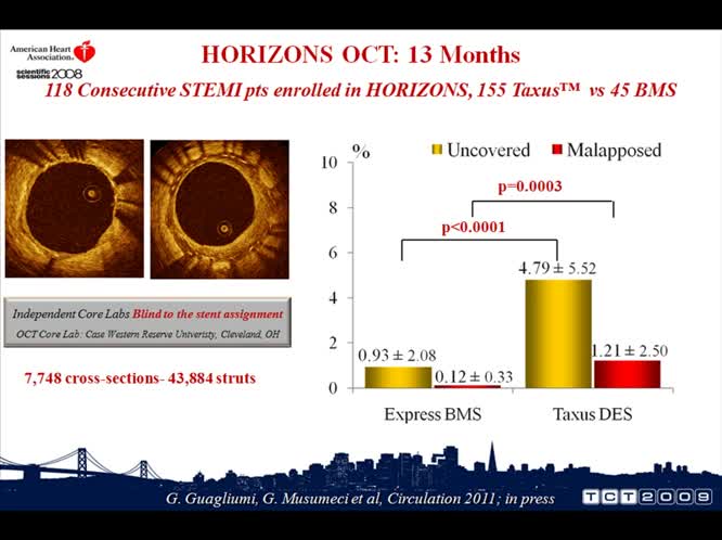 Imaging intracoronarico, endotelio, stent medicati