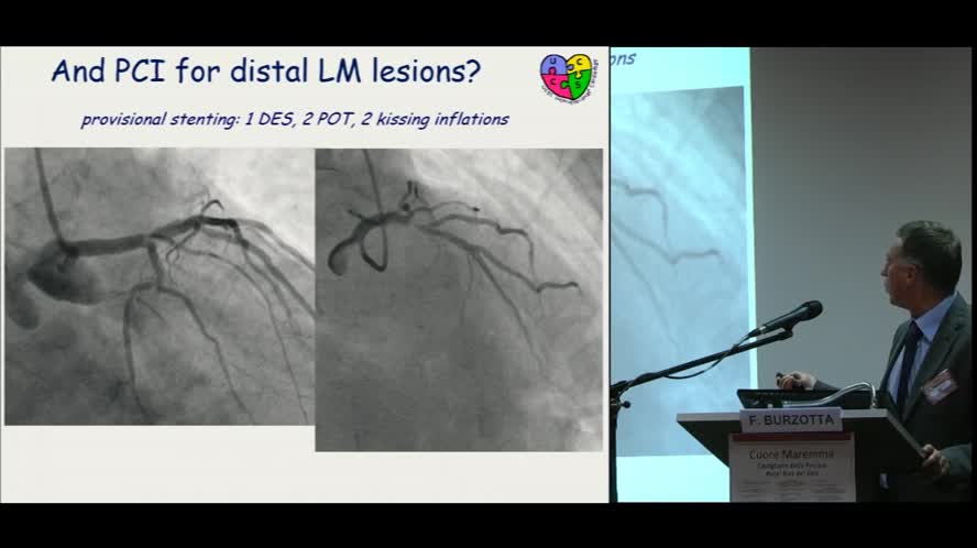 Malattia del tronco comune: c'è ancora spazio per la chirurgia?