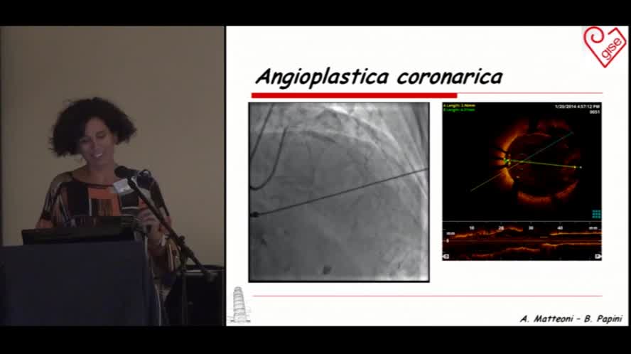 Gestione di un paziente "speciale" in urgenza in sala emodinamica