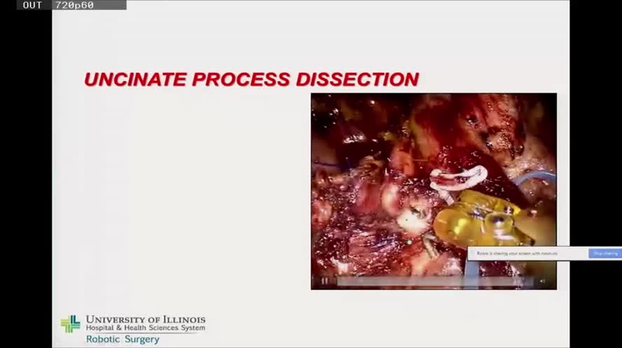 Video Conference from Chicago, USA - Robotic surgery: state of the art and future perspectives