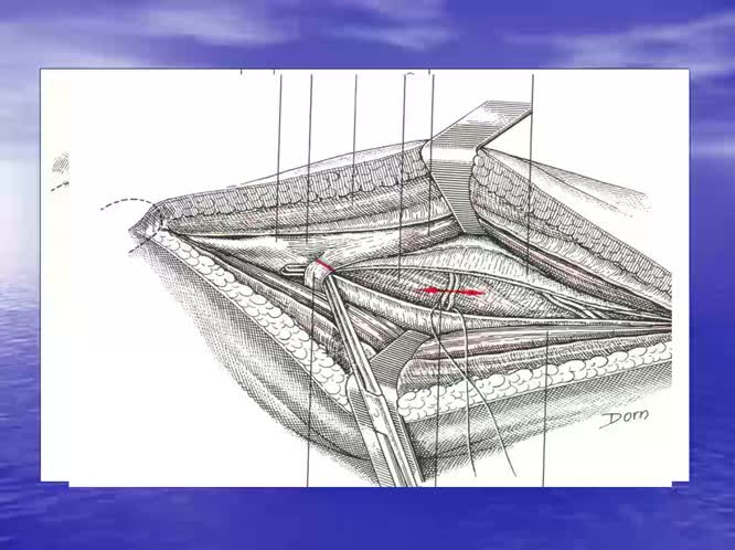 Vie di accesso standard