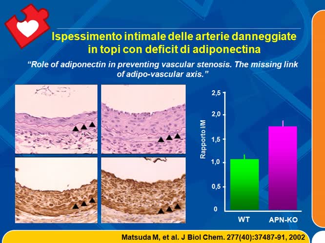 Esperienza sul campo e ruolo dell.ecocolor-doppler: Metabolismo lipidico - Metabolismo glucidico (insulino-resistenza) - Metabolismo osseo