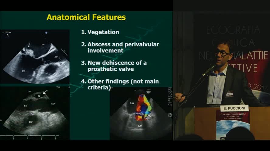 Diagnosi ecografica di endocardite