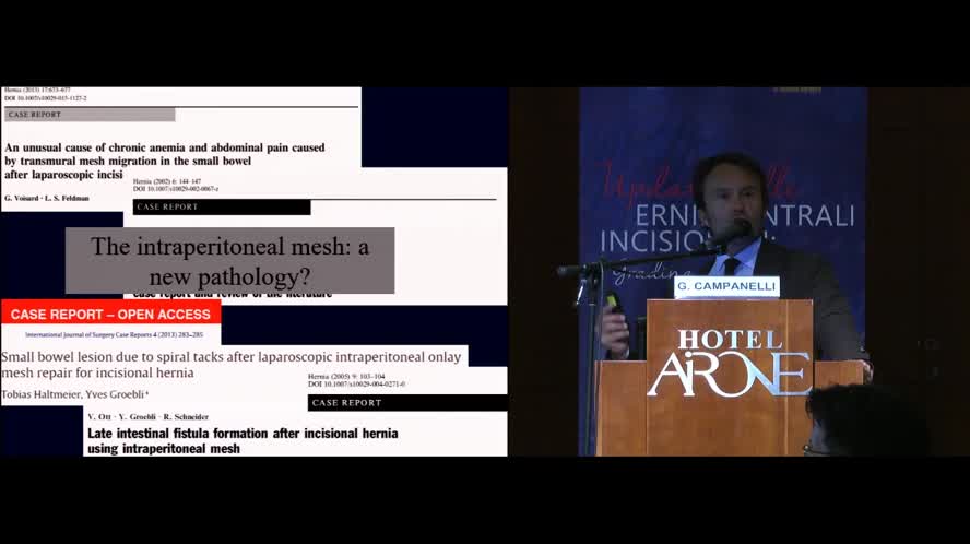 Tailored surgery della chirurgia riparativa della parete addominale