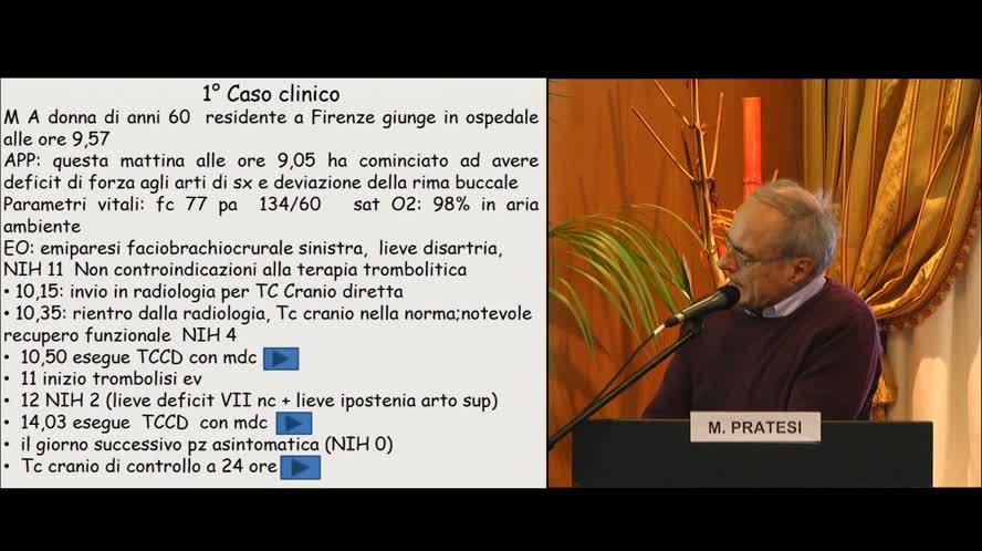 L'ECD transcranico nell'ictus acuto