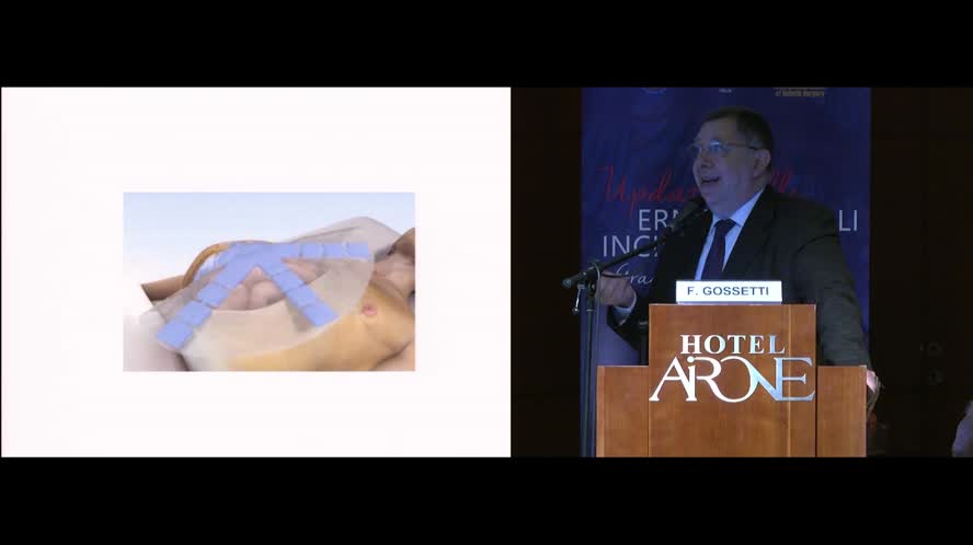 Addome aperto e trattamento con VAC