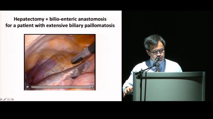 Robotic liver surgery: there are technical limits?