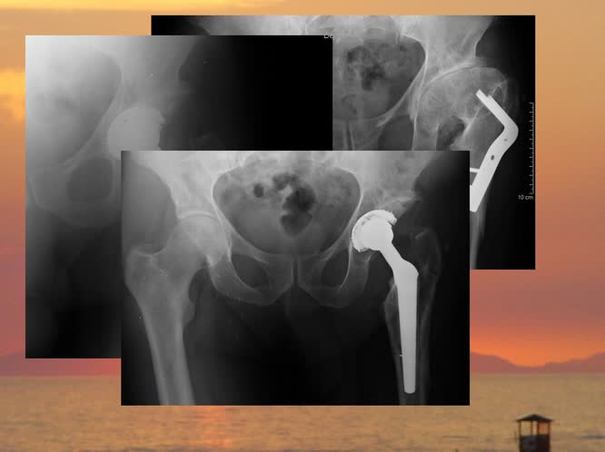 Il cotile ad espansione