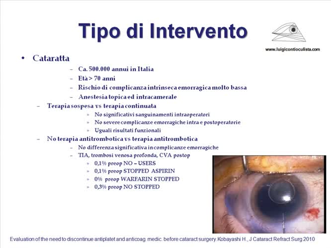 Il parere dell'oculista