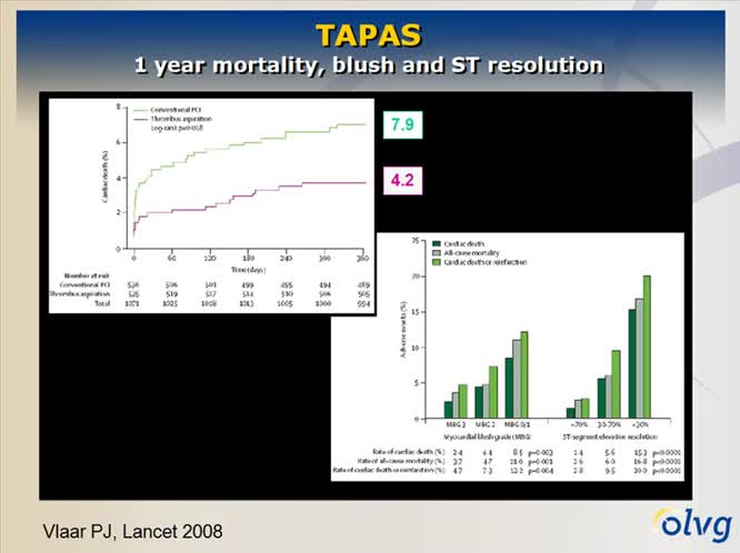 Angioplastica primaria