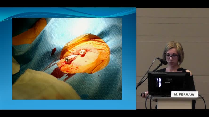 Esperienza TAVI in elezione