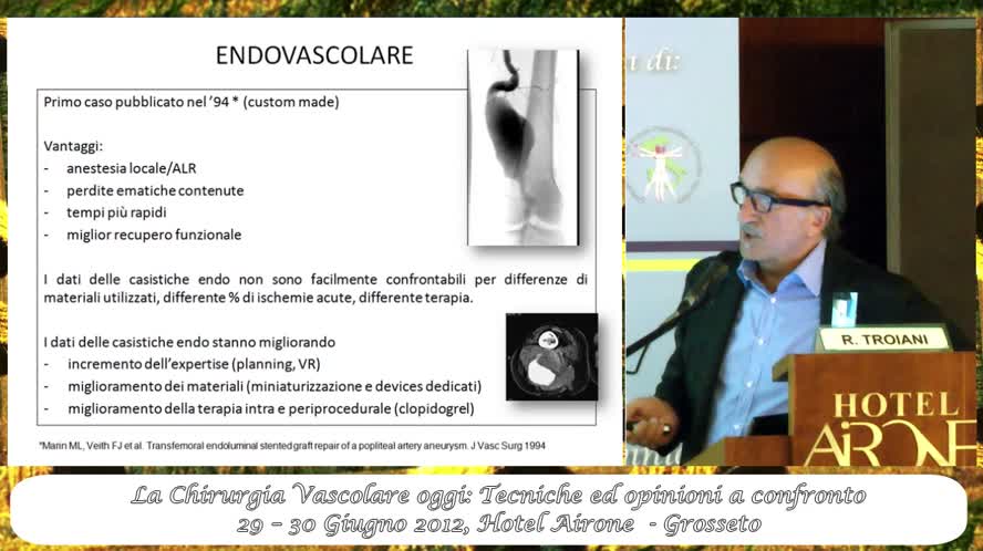 Aneurismi poplitei terapia open versus endovascolare