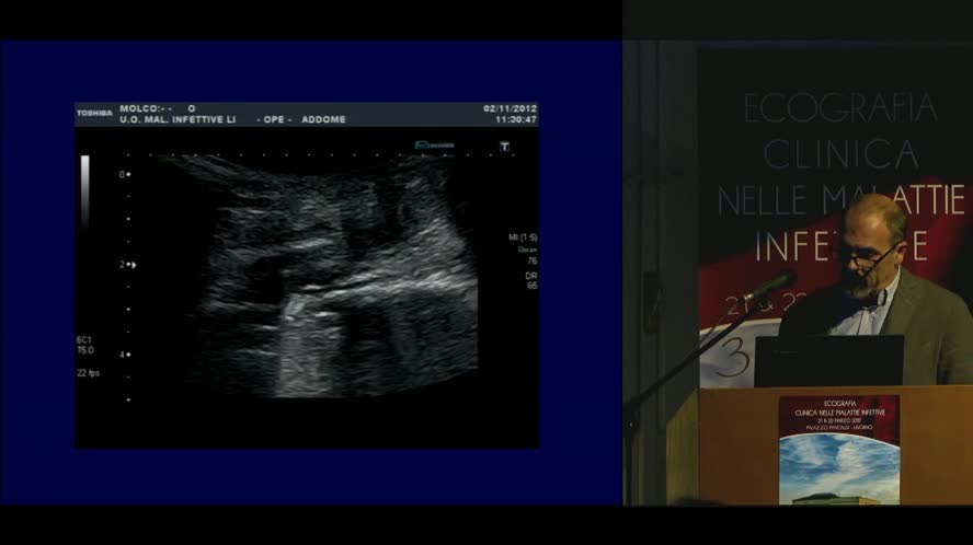Casi clinici: Infezioni ortopediche 