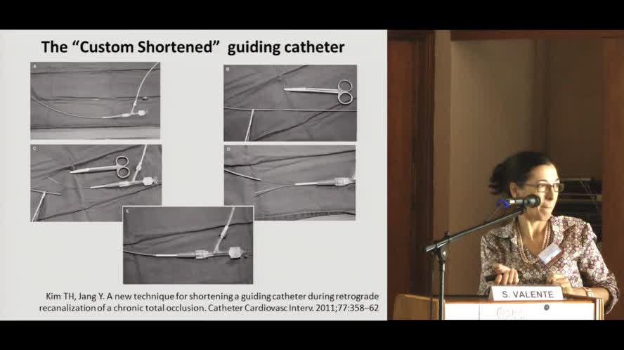 Quando il cardiochirurgo ci mette le mani