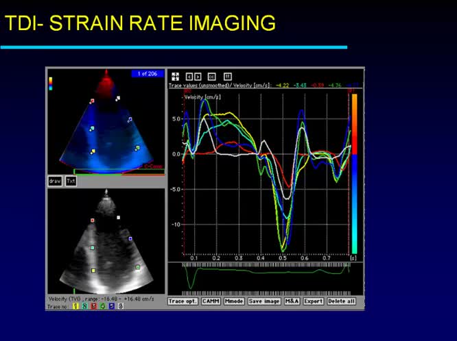 Attivita sportiva nell ipertensione