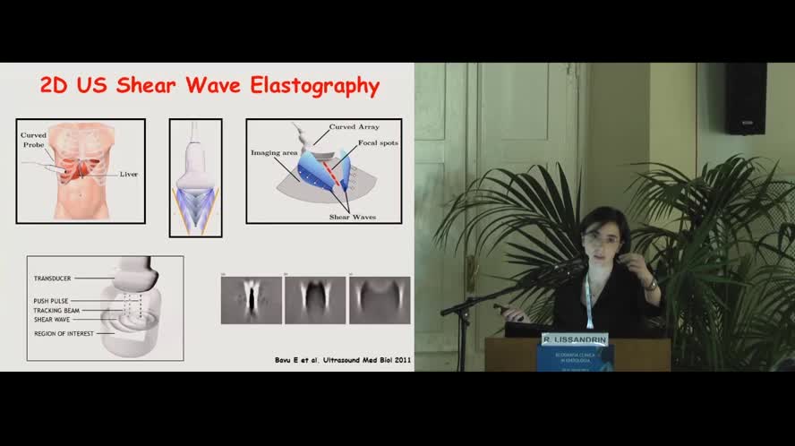 Valutazione non invasiva della fibrosi epatica - Elastosonografia