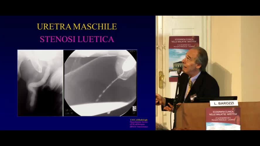 Infezioni renali e del tratto genito-urinario maschile