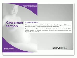 Secondo Caso Clinico con televoter