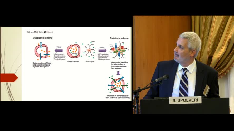 Ictus ischemico complicato da edema cerebrale: fattori di rischio, presentazione clinica e trattamento