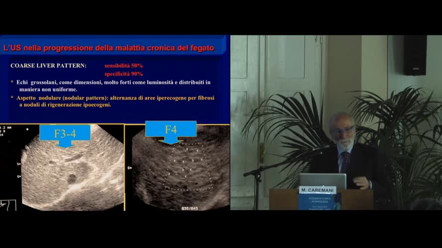 Dall'epatite cronica alla cirrosi