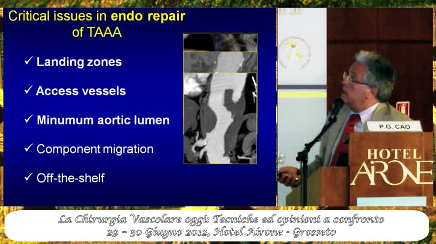 Indicazioni, limiti e risultati delle endoprotesi ramificate e fenestrate nel trattamento degli AAA