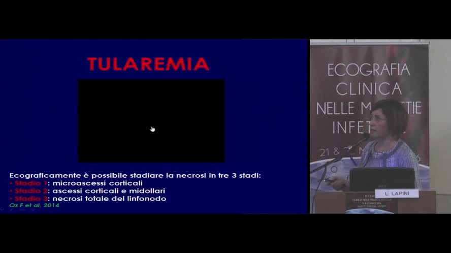 Diagnostica ecografica nelle linfoadenopatie infettive e nelle sindromi mononucleosiche