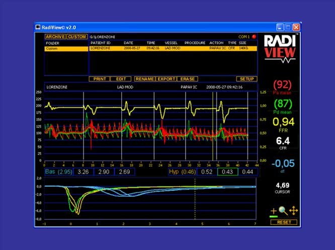 Analisi Anatomo-funzionale del Circolo Coronarico