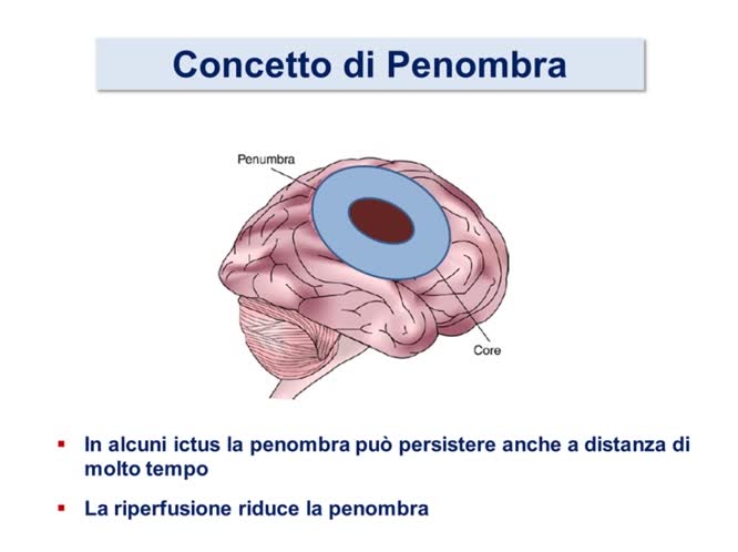 Fisiopatologia e terapia Stroke