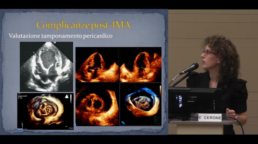 Esperienza del sonographer in cardiologia interventistica