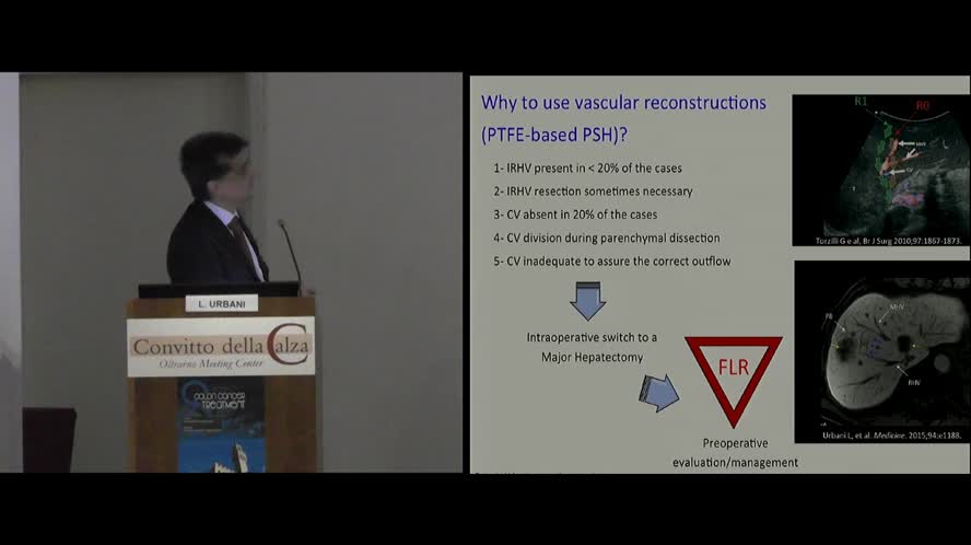 Minor but challeging liver resections and vascular recostruction
