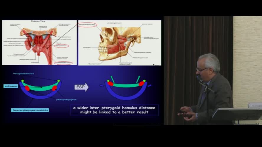 Faringoplastica laterale